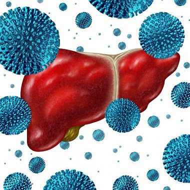 Хронический вирусный гепатит С с исходом в цирроз и гепатоцеллюлярную карциному (клиническое наблюдение)